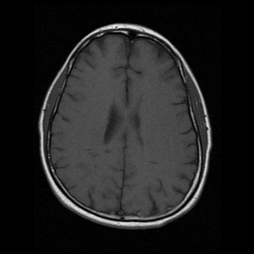 My Brain. Brain MRI Pictures.