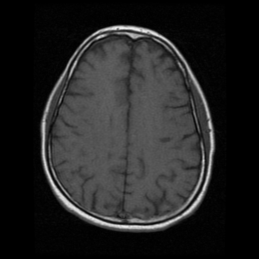 My Brain. Brain MRI Pictures.