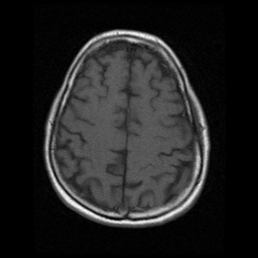 My Brain. Brain MRI Pictures.