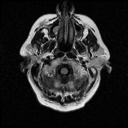 My Brain. Brain MRI Pictures.