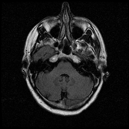 My Brain. Brain MRI Pictures.