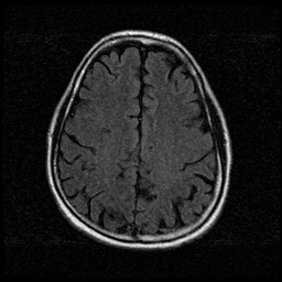 My Brain. Brain MRI Pictures.