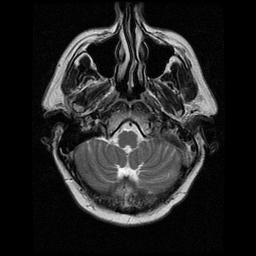 My Brain. Brain MRI Pictures.