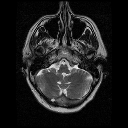 My Brain. Brain MRI Pictures.