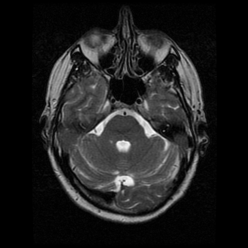 My Brain. Brain MRI Pictures.