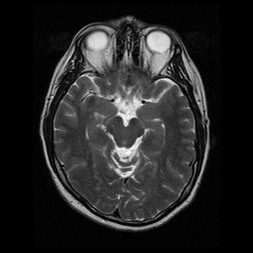 My Brain. Brain MRI Pictures.