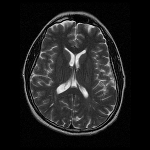 My Brain. Brain MRI Pictures.