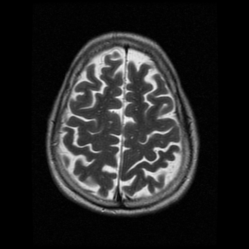 My Brain. Brain MRI Pictures.