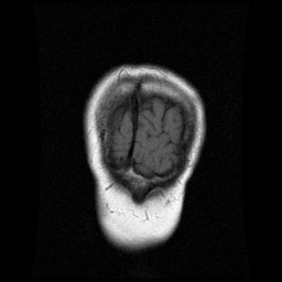 My Brain. Brain MRI Pictures.