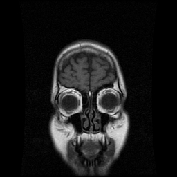 My Brain. Brain MRI Pictures.