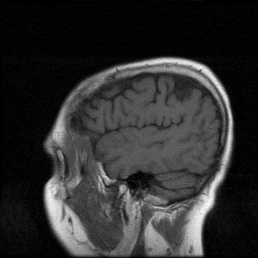 My Brain. Brain MRI Pictures.