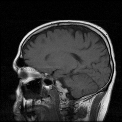 My Brain. Brain MRI Pictures.