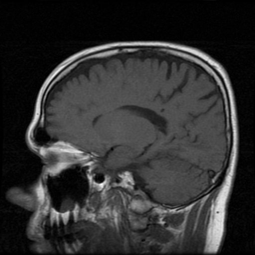 My Brain. Brain MRI Pictures.