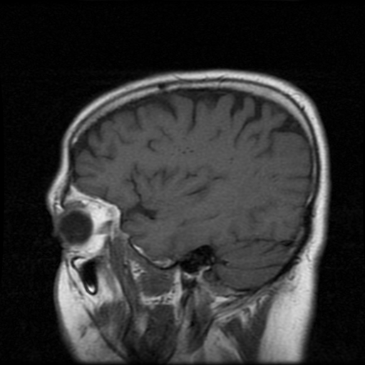 My Brain. Brain MRI Pictures.