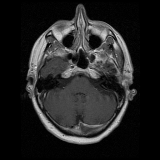 My Brain. Brain MRI Pictures.