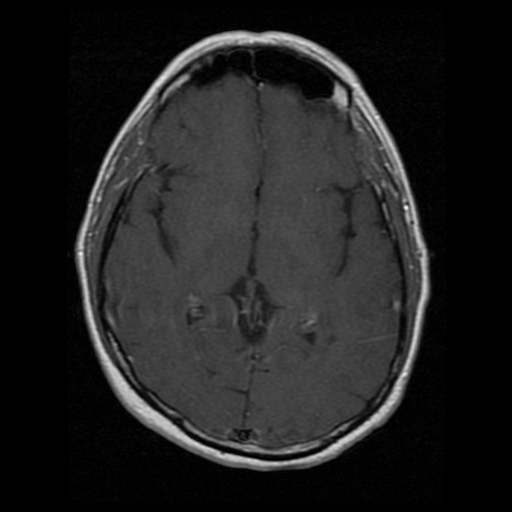 My Brain. Brain MRI Pictures.