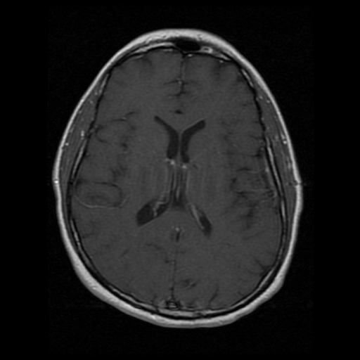 My Brain. Brain MRI Pictures.