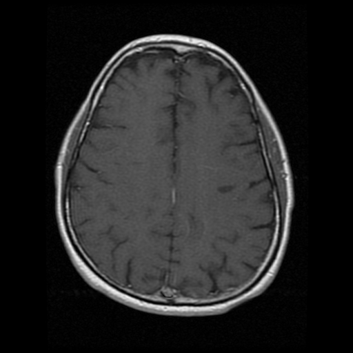 My Brain. Brain MRI Pictures.