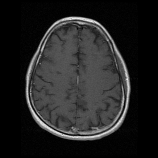 My Brain. Brain MRI Pictures.