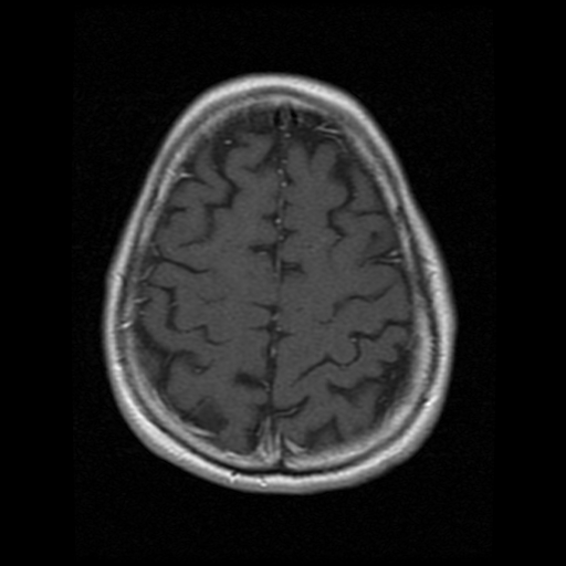 My Brain. Brain MRI Pictures.