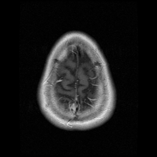 My Brain. Brain MRI Pictures.