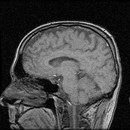 My Brain. Brain MRI Pictures.