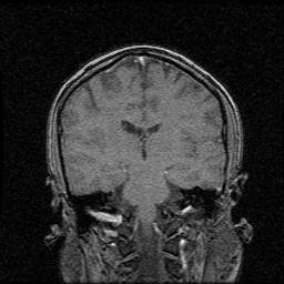 My Brain. Brain MRI Pictures.