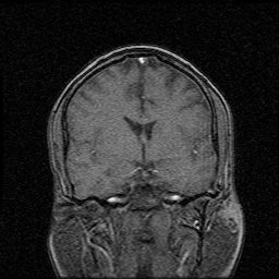 My Brain. Brain MRI Pictures.